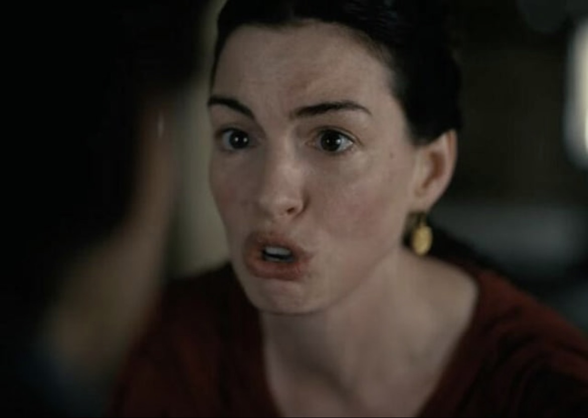 3) anne’s botox